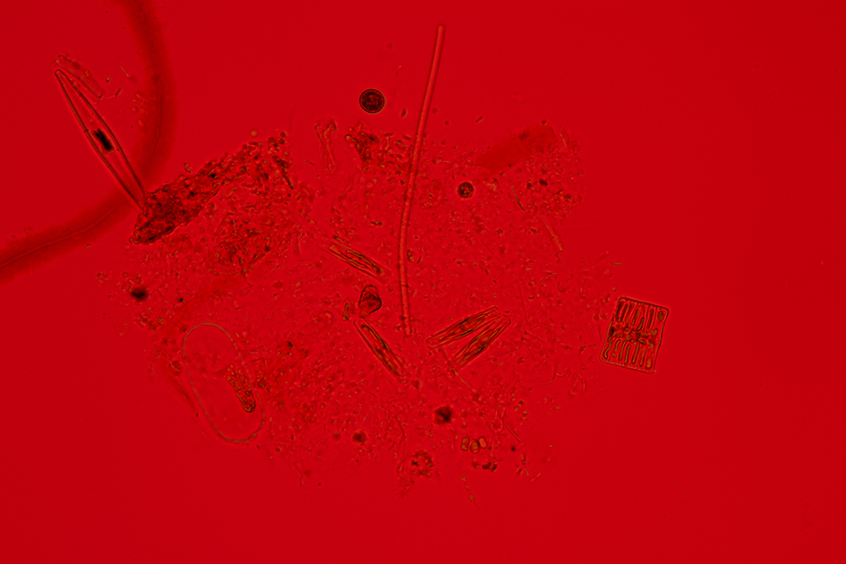 Izabela Zolcinska Work 030 Image 08